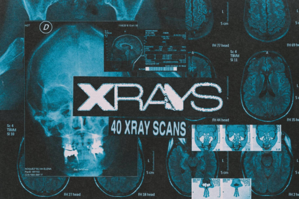 40款复古做旧噪点黑暗冷酷医学人体头骨X光片背景图片设计素材 Design syndrome – X-Rays Image Pack